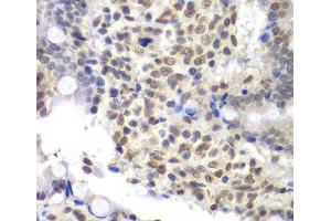 Immunohistochemistry of paraffin-embedded Rat Intestine using U2AF1 Polyclonal Antibody at dilution of 1:200 (40x lens). (U2AF1 anticorps)