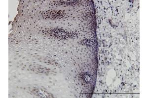 Immunoperoxidase of monoclonal antibody to DLX2 on formalin-fixed paraffin-embedded human esophagus. (DLX2 anticorps  (AA 1-110))