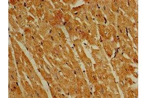 Immunohistochemistry of paraffin-embedded human heart tissue using ABIN7163291 at dilution of 1:100