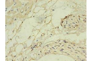 Immunohistochemistry of paraffin-embedded human heart using  in 30 μg/mL dilute concentrations. (NPPB anticorps)