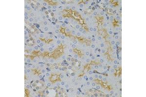 Immunohistochemistry of paraffin-embedded mouse kidney using CDKN2C antibody. (CDKN2C anticorps)