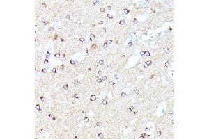 Immunohistochemistry of paraffin-embedded mouse brain using CCDC6 antibody (ABIN7266442) at dilution of 1:100 (40x lens). (CCDC6 anticorps  (AA 55-222))
