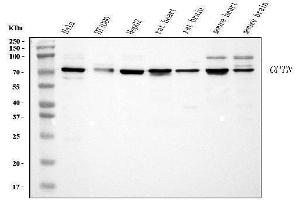 Western blot analysis of Optineurin using anti-Optineurin antibody (ABIN3042498). (OPTN anticorps  (AA 241-577))