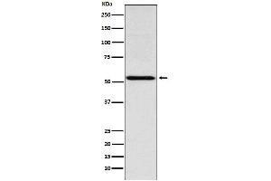 Western blot analysis of THRA expression in Jurkat cell lysate.