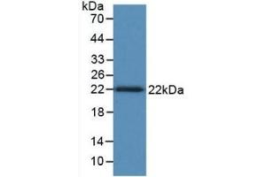 Detection of Recombinant TNFb, Human using Monoclonal Antibody to Tumor Necrosis Factor Beta (TNFb) (LTA anticorps  (AA 36-205))