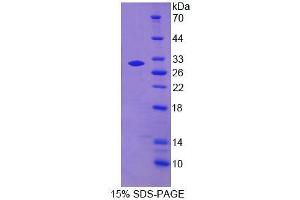 SDS-PAGE analysis of Human MPG Protein. (MPG Protéine)