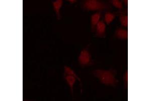 ABIN6266953 staining HepG2 by IF/ICC.