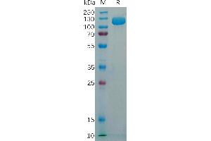 Human CD56 Protein, His Tag on SDS-PAGE under reducing condition.