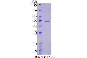 SDS-PAGE (SDS) image for Insulin-Like Growth Factor 1 Receptor (IGF1R) (AA 763-955) protein (His tag) (ABIN2125279)
