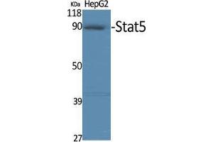 Western Blot (WB) analysis of specific cells using Stat5 Polyclonal Antibody. (STAT5A anticorps)