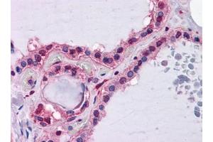 Immunohistochemistry (IHC) image for anti-Hepcidin Antimicrobial Peptide (HAMP) (AA 25-85) antibody (ABIN614727)