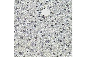 Immunohistochemistry of paraffin-embedded mouse liver using SMN2 antibody. (SMN1 anticorps)