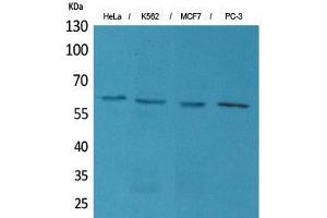 Western Blot (WB) analysis of HeLa, K562, MCF7, PC-3 cells using p63 Polyclonal Antibody. (TCP1 alpha/CCTA anticorps  (N-Term))