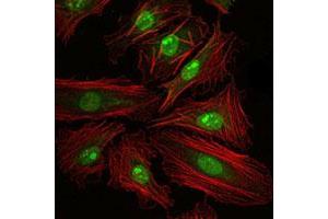 Immunofluorescence analysis of HeLa cells using CREB1 monoclonal antibody, clone 5G3  (green) . (CREB1 anticorps)