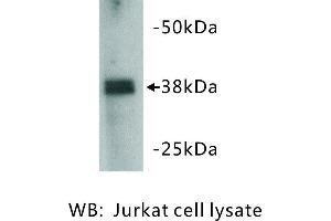 Image no. 1 for anti-Zinc Finger Protein 42 (ZFP42) antibody (ABIN1112835) (ZFP42 anticorps)