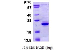 SDS-PAGE (SDS) image for TRAF-Interacting Protein with Forkhead-Associated Domain (TIFA) (AA 1-184) protein (His tag) (ABIN668024)