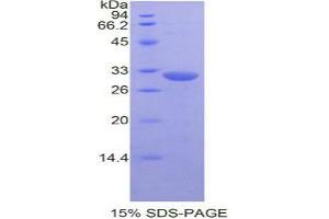 SDS-PAGE analysis of Mouse MAPK8 Protein. (JNK Protéine)