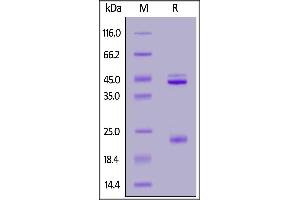 Human IL-23A & Rat IL-12B Heterodimer Protein, His Tag&Tag Free on  under reducing (R) condition.