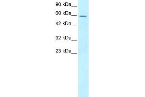 WB Suggested Anti-FOXG1A Antibody Titration:  5.