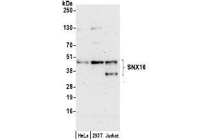 anti-Sorting Nexin 16 (SNX16) (AA 250-300) antibody