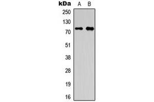 Western blot analysis of OLFML2A expression in HepG2 (A), A549 (B) whole cell lysates. (OLFML2A anticorps  (Center))