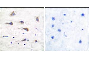 Immunohistochemical analysis of paraffin-embedded human brain tissue using GluR6 antibody. (Metabotropic Glutamate Receptor 6 anticorps)