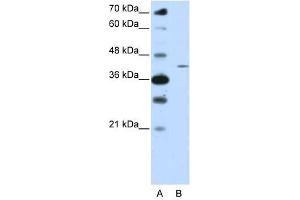 ZNF488 antibody used at 0. (ZNF488 anticorps  (N-Term))