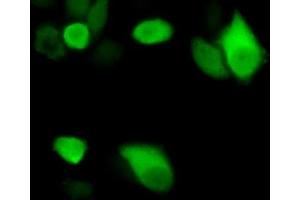 Detection of ENO3 in Hela cells using Polyclonal Antibody to Enolase 3 (ENO3)
