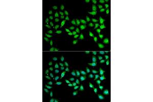 Immunofluorescence analysis of U2OS cells using UCN2 antibody (ABIN5973879). (Urocortin 2 anticorps)
