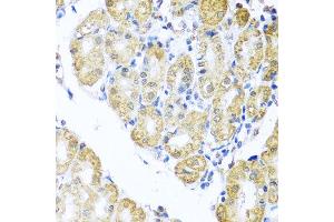 Immunohistochemistry of paraffin-embedded human stomach using BNIP3L antibody at dilution of 1:100 (x40 lens).