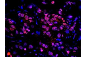 Immunofluorescence (IF) image for anti-Ubiquitin Interaction Motif Containing 1 (UIMC1) (C-Term) antibody (ABIN7449010) (UIMC1 anticorps  (C-Term))