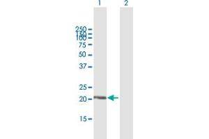 anti-Dual Specificity Phosphatase 18 (DUSP18) (AA 1-188) antibody