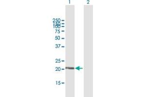 Western Blot analysis of DUSP18 expression in transfected 293T cell line by DUSP18 MaxPab polyclonal antibody. (DUSP18 anticorps  (AA 1-188))
