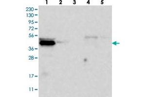 Western blot analysis of Lane 1: RT-4, Lane 2: U-251 MG, Lane 3: Human Plasma, Lane 4: Liver, Lane 5: Tonsil with C9orf41 polyclonal antibody  at 1:250-1:500 dilution. (C9orf41 anticorps)