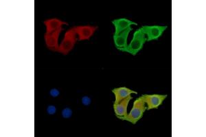 ABIN7097074 and ABIN7101141 staining Hela cells by IF/ICC.
