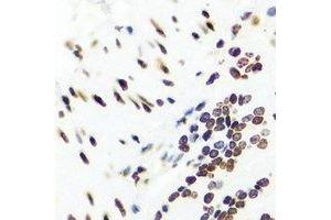 Immunohistochemistry (IHC) image for anti-Nuclear Receptor Subfamily 5, Group A, Member 2 (NR5A2) antibody (ABIN7308100)