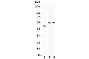 Western blot testing of CYP2E1 antibody and Lane 1:  rat liver;  2: human HeLa;  3: (h) Jurkat;  Observed size: 56-65KD (CYP2E1 anticorps  (AA 1-310))