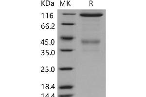 Western Blotting (WB) image for Met Proto-Oncogene (MET) (Active) protein (Fc Tag) (ABIN7196991)