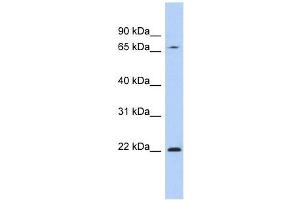 RPS7 antibody used at 1 ug/ml to detect target protein.