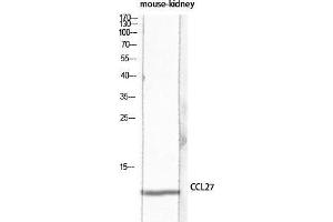 Western Blot (WB) analysis of Mouse Kidney lysis using CCL27 antibody.