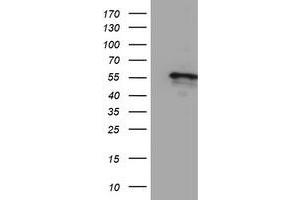 Western Blotting (WB) image for anti-Cytochrome P450, Family 2, Subfamily A, Polypeptide 6 (CYP2A6) antibody (ABIN1497723) (CYP2A6 anticorps)
