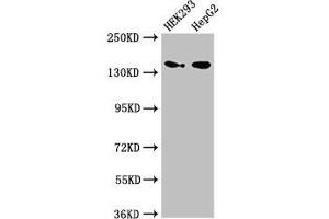 Western Blot Positive WB detected in: HEK293 whole cell lysate, HepG2 whole cell lysate All lanes: MAN2A1 antibody at 3. (alpha-Mannosidase II anticorps  (AA 31-181))