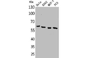 Western Blot analysis of HeLa K562 MCF7 PC-3 cells using p63 Polyclonal Antibody (p63 anticorps  (N-Term))