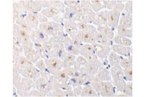 Image no. 1 for anti-Tumor Necrosis Factor Receptor Superfamily, Member 6b, Decoy (TNFRSF6B) (C-Term) antibody (ABIN202893)