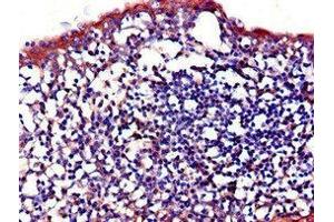 Immunohistochemistry of paraffin-embedded human tonsil tissue using ABIN7156864 at dilution of 1:100 (IL23R anticorps  (AA 15-125))