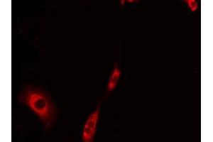 ABIN6275237 staining LOVO by IF/ICC. (MRPS30 anticorps  (C-Term))