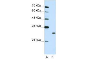 WB Suggested Anti-MBNL1 Antibody Titration:  2. (MBNL1 anticorps  (C-Term))