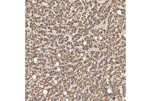 IHC analysis of Sm-D3/SNRPD3 using anti-Sm-D3/SNRPD3 antibody (ABIN7598952).