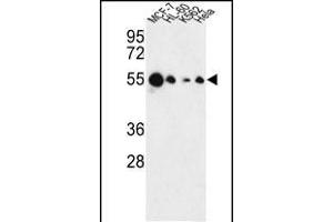 Western blot analysis of AIM2 Antibody (N-term) (ABIN653833 and ABIN2843099) in MCF-7, HL-60, K562, Hela cell line lysates (35 μg/lane). (AIM2 anticorps  (N-Term))