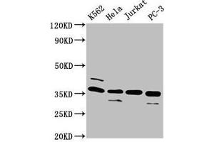 Western Blot Positive WB detected in: K562 whole cell lysate, Hela whole cell lysate, Jurkat whole cell lysate, PC-3 whole cell lysate All lanes: ATG3 antibody at 4 μg/mL Secondary Goat polyclonal to rabbit IgG at 1/50000 dilution Predicted band size: 36 kDa Observed band size: 36 kDa (ATG3 anticorps  (AA 1-314))
